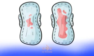 لکه بینی بعد از آی یو آی روی پد بهداشتی پرویودی خانم ها