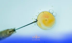 انجام لقاح مصنوعی در آزمایشگاه برای تکرار IVF