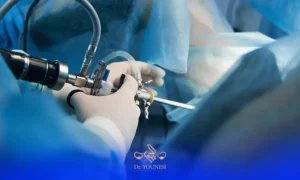 عکس دست پزشک در حال انجام لاپاراسکوپی رحم