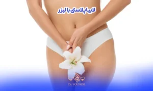 نتیجه بعد از لابیاپلاستی با لیزر