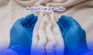 درست کردن شکل واژن با دست | مراقبت‌ های بعد از لابیاپلاستی