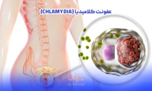 عکس نمایش عفونت کلامیدیا در ناحیه تناسلی یک خانم