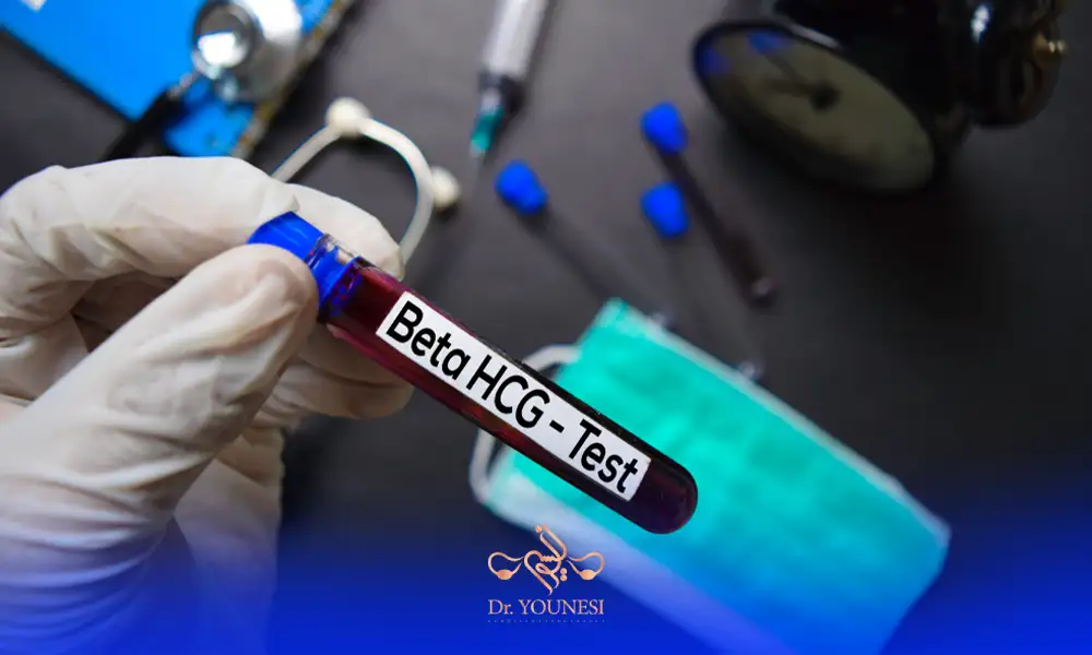 آزمایش بتا در دست پزشک