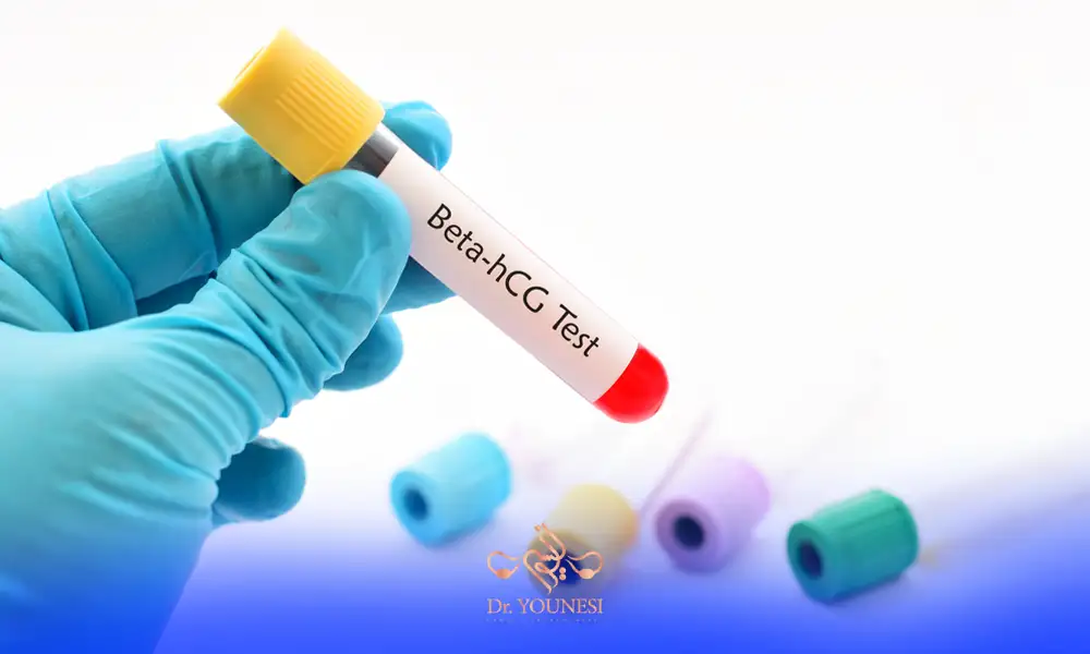 نمونه آزمایش بتا