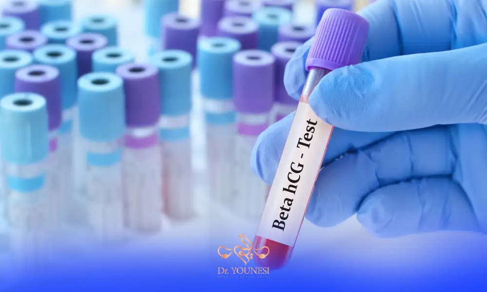 لوله های آزمایش بتا