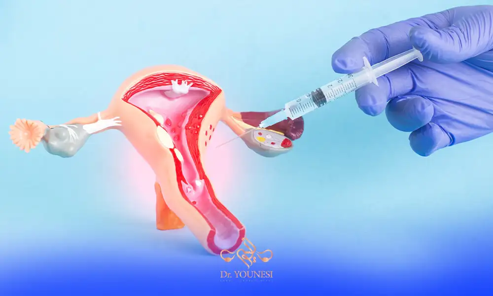 پزشک در انجام آی یو آی روی ماکت رحم | علت منفی شدن آی یو آی