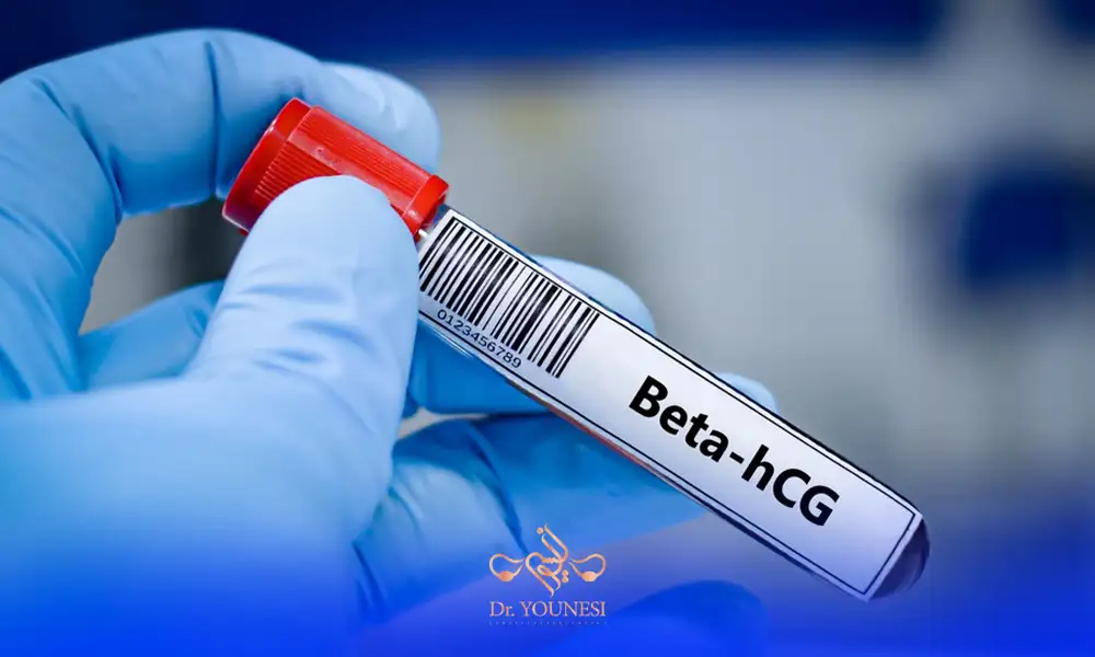 آزمایش بتا برای بارداری و درمان ناباروری