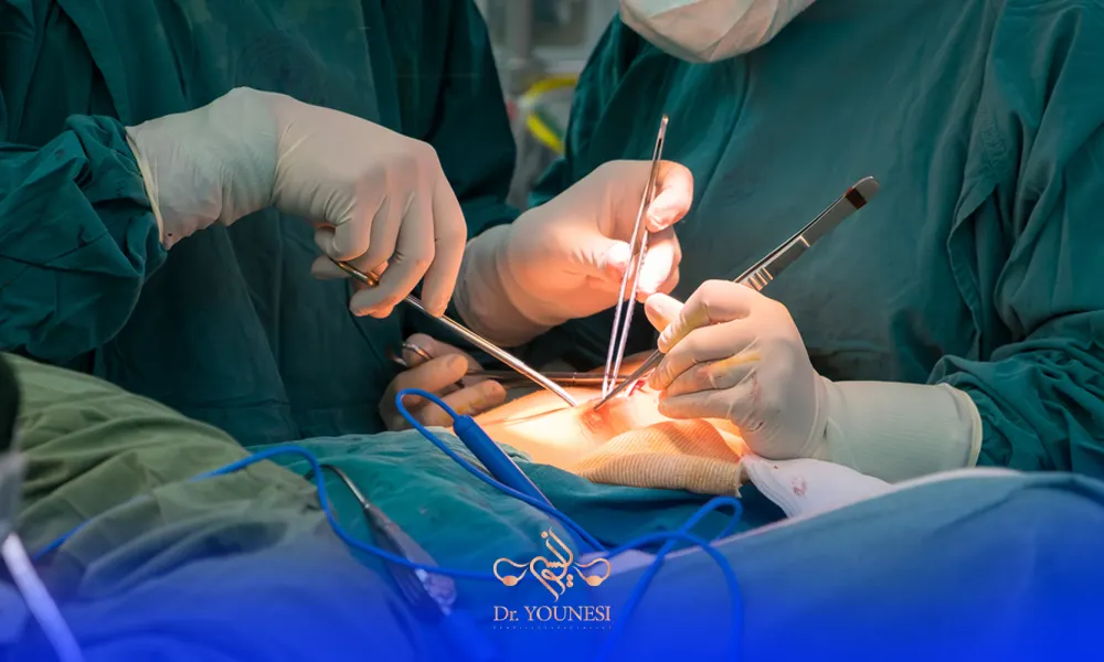 تفاوت عوارض لاپاراتومی با عمل لاپاراسکوپی