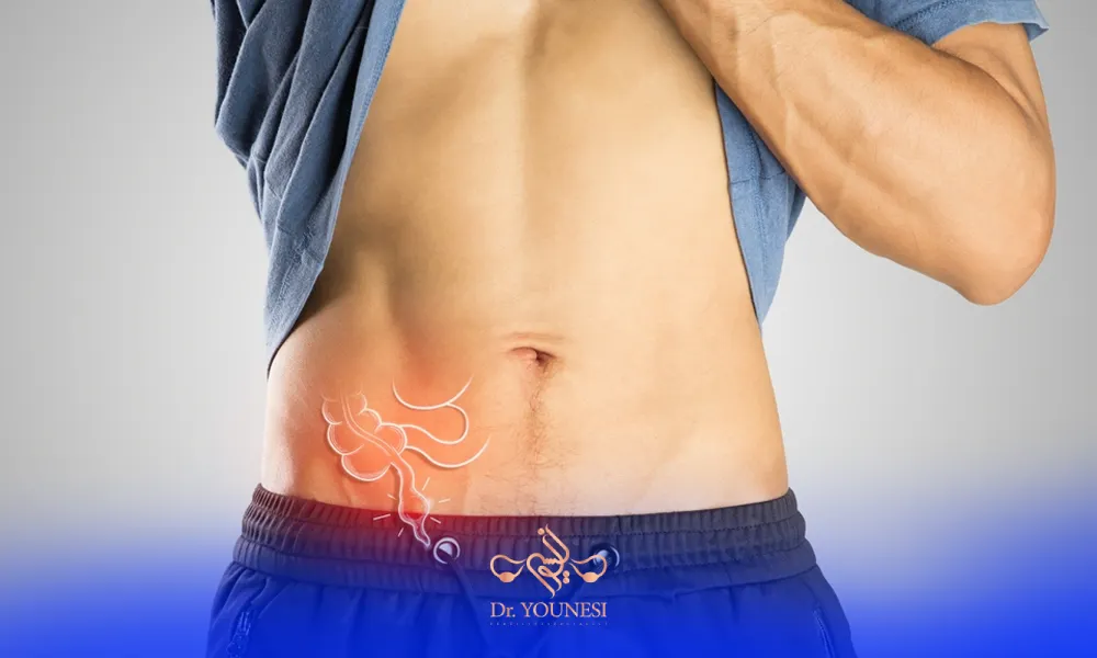 عوارض لاپاراتومی در مردان و پیامدهای احتمالی آن