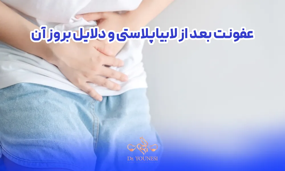 عفونت بعد از لابیاپلاستی و دلایل بروز آن