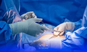 تصویر اتاق عمل لاپاراتومی، عوارض عمل لاپاراتومی