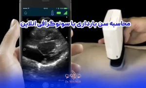 محاسبه سن بارداری با سونوگرافی انلاین