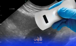 چگونه سن بارداری خود را با سونوگرافی آنلاین محاسبه کنیم؟