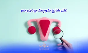 علل شایع کوچک بودن رحم