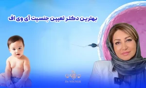 بهترین دکتر تعیین جنسیت آی وی اف