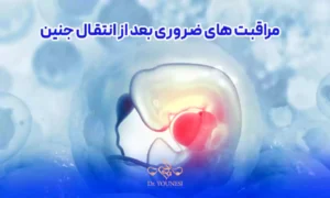 مراقبت های ضروری بعد از انتقال جنین