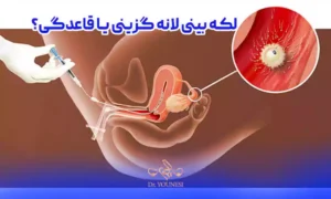 لکه بینی لانه گزینی یا قاعدگی؟ ۵ راه تمایز سریع