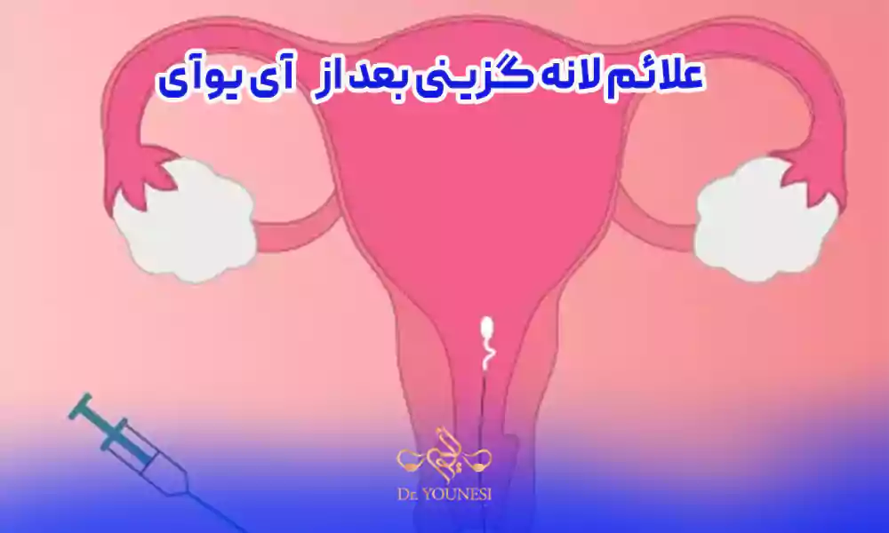 علائم لانه گزینی بعد از آی یو آی