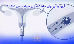 آی یو آی برای چه کسانی جواب نمی دهد؟