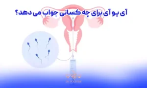 آی یو آی برای چه کسانی جواب می دهد