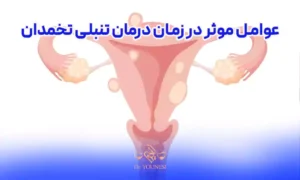 عوامل موثر در زمان درمان تنبلی تخمدان