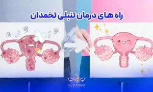 تنبلی تخمدان و راه درمانی برای تنبلی تخمدان