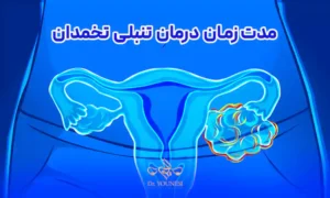 درمان تنبلی تخمدان چقدر طول میکشد؟