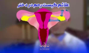  علائم کیست رحم در دختر