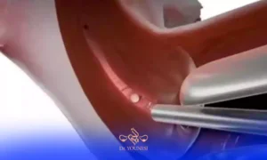 مدت زمان طبیعی کمر درد بعد از کورتاژ