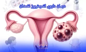 درمان دارویی اندومتریوز تخمدان