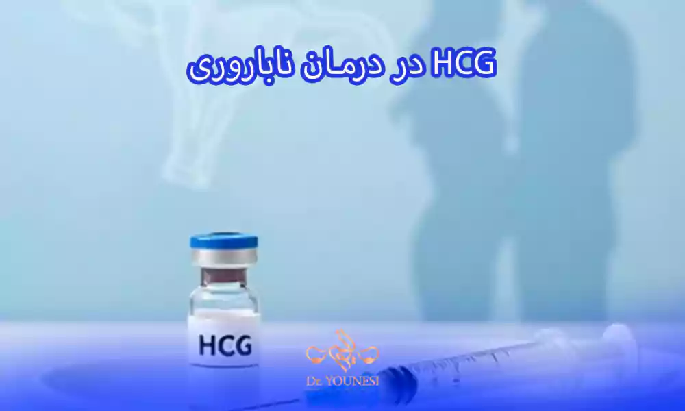 آمپول HCG چیست و زمان مناسب تزریق hcg در درمان ناباروری