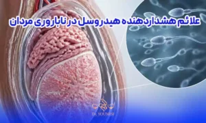 علائم هشداردهنده هیدروسل در ناباروری مردان