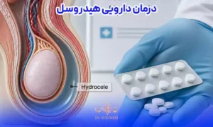درمان دارویی هیدروسل؛ چه زمانی مؤثر است؟