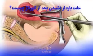 علت باردار نشدن بعد از کورتاژ چیست؟