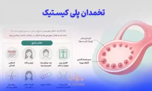 بهترین روش های درمان تخمدان پلی کیستیک