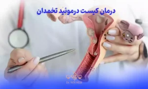 نحوه تشخیص کیست درموئید و درمان درموئید تخمدان
