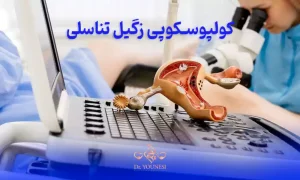کولپوسکوپی زگیل تناسلی