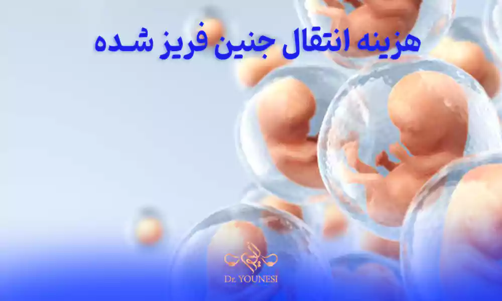 هزینه انتقال جنین فریز شده