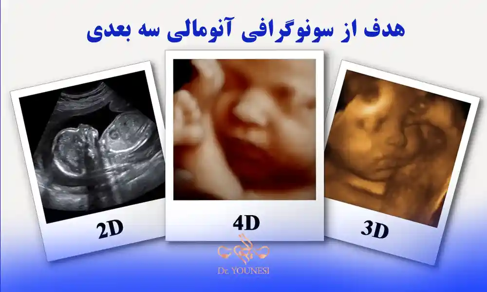 هدف از سونوگرافی آنومالی سه بعدی چیست؟