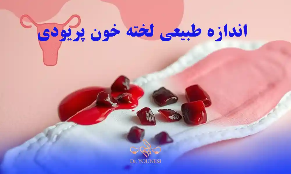 لخته خون در پریودی تا چه اندازه طبیعی است؟
