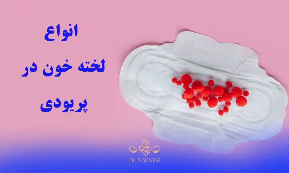 لخته خون در پریودی تا چه اندازه طبیعی است؟